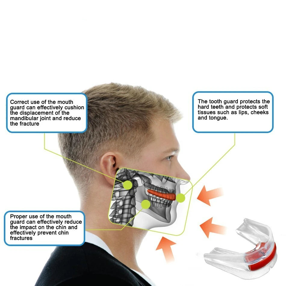Protège-Dents Sport EVA Thermoformable – Boxe, Rugby, Basketball, Karate, Sanda | Enfants & Adultes | 11 Variantes - BLACKBEARD OUTDOOR INDUSTRIES