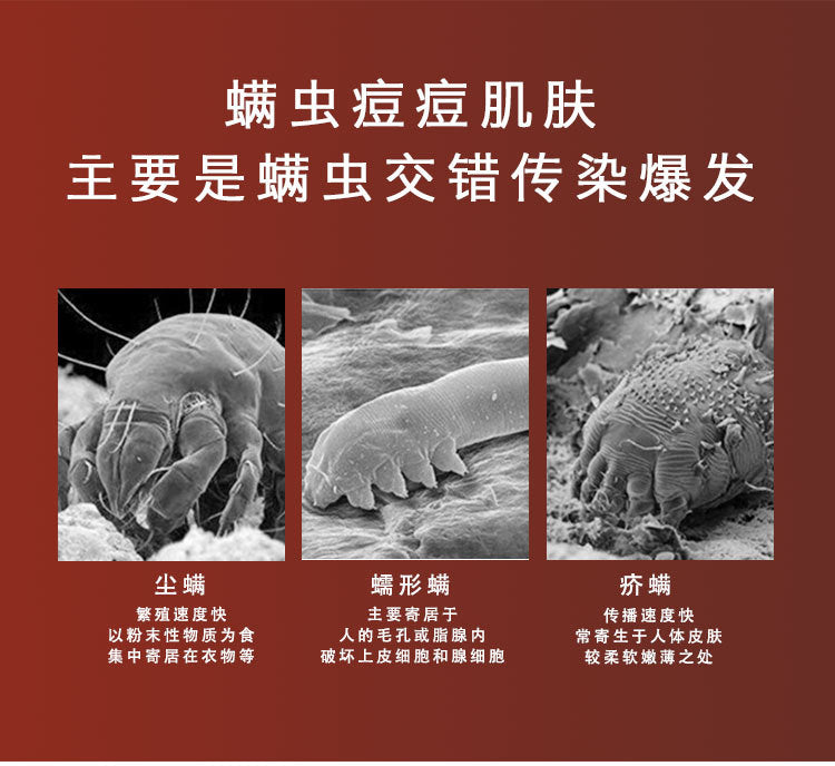 Savon Noir Tibétain Artisanal – Formule Ancestrale aux Plantes Médicinales - BLACKBEARD OUTDOOR INDUSTRIES