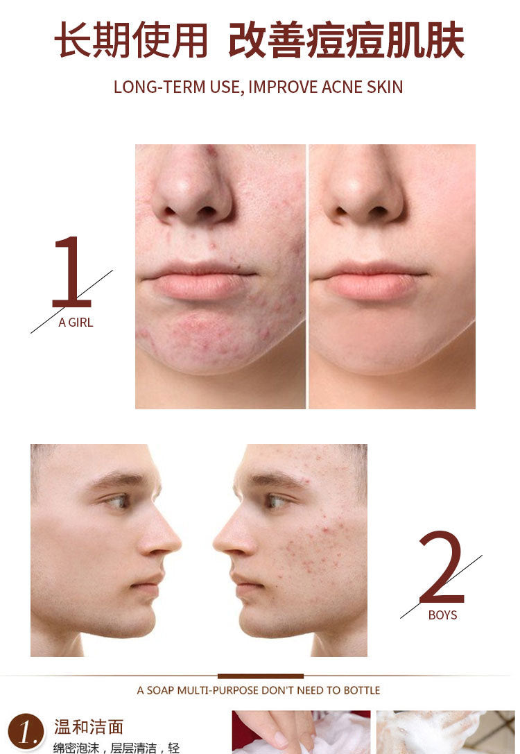 Savon Noir Tibétain Artisanal – Formule Ancestrale aux Plantes Médicinales - BLACKBEARD OUTDOOR INDUSTRIES