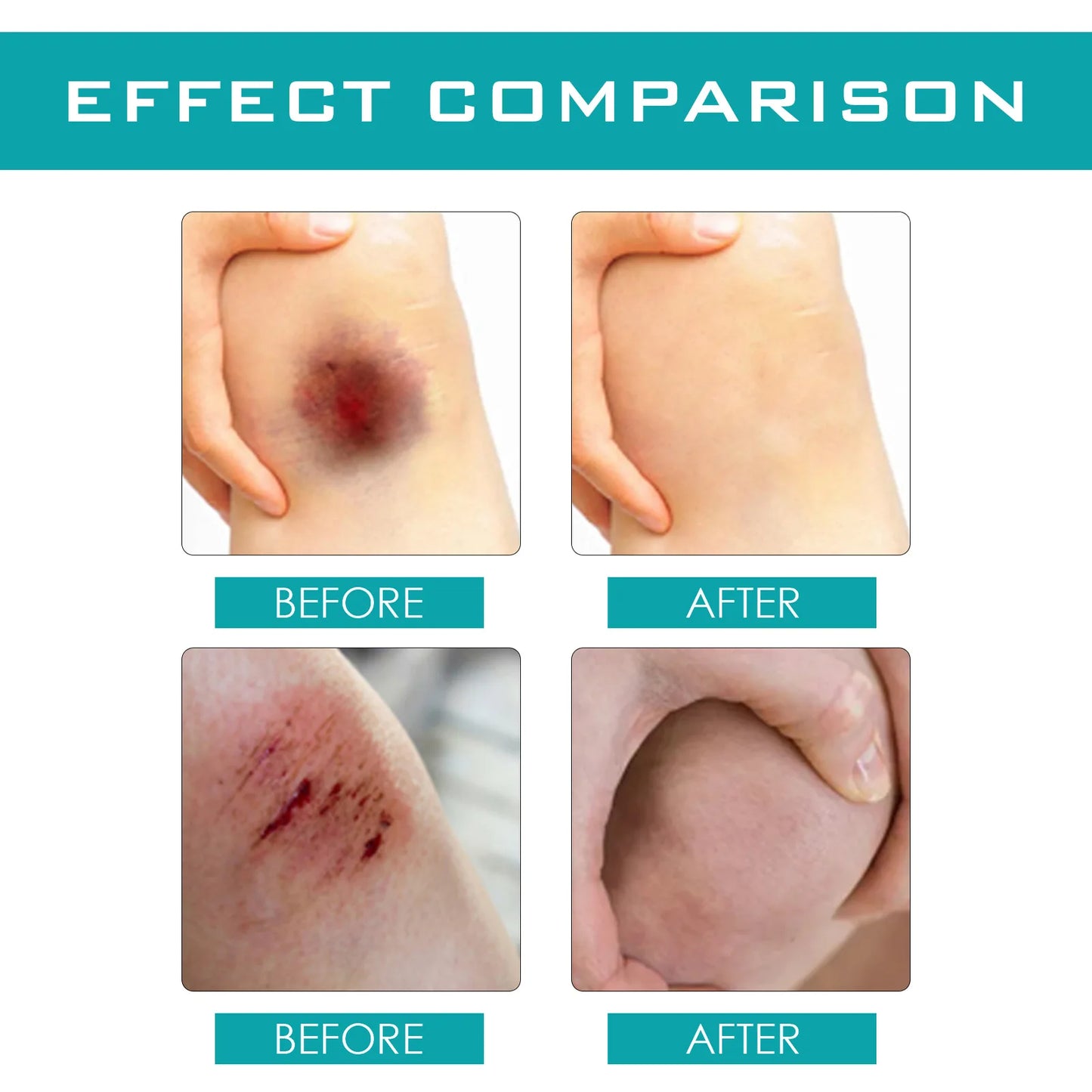 Pansement Spray  - Soin cutané désinfectant et cicatrisant liquide - BLACKBEARD OUTDOOR INDUSTRIES