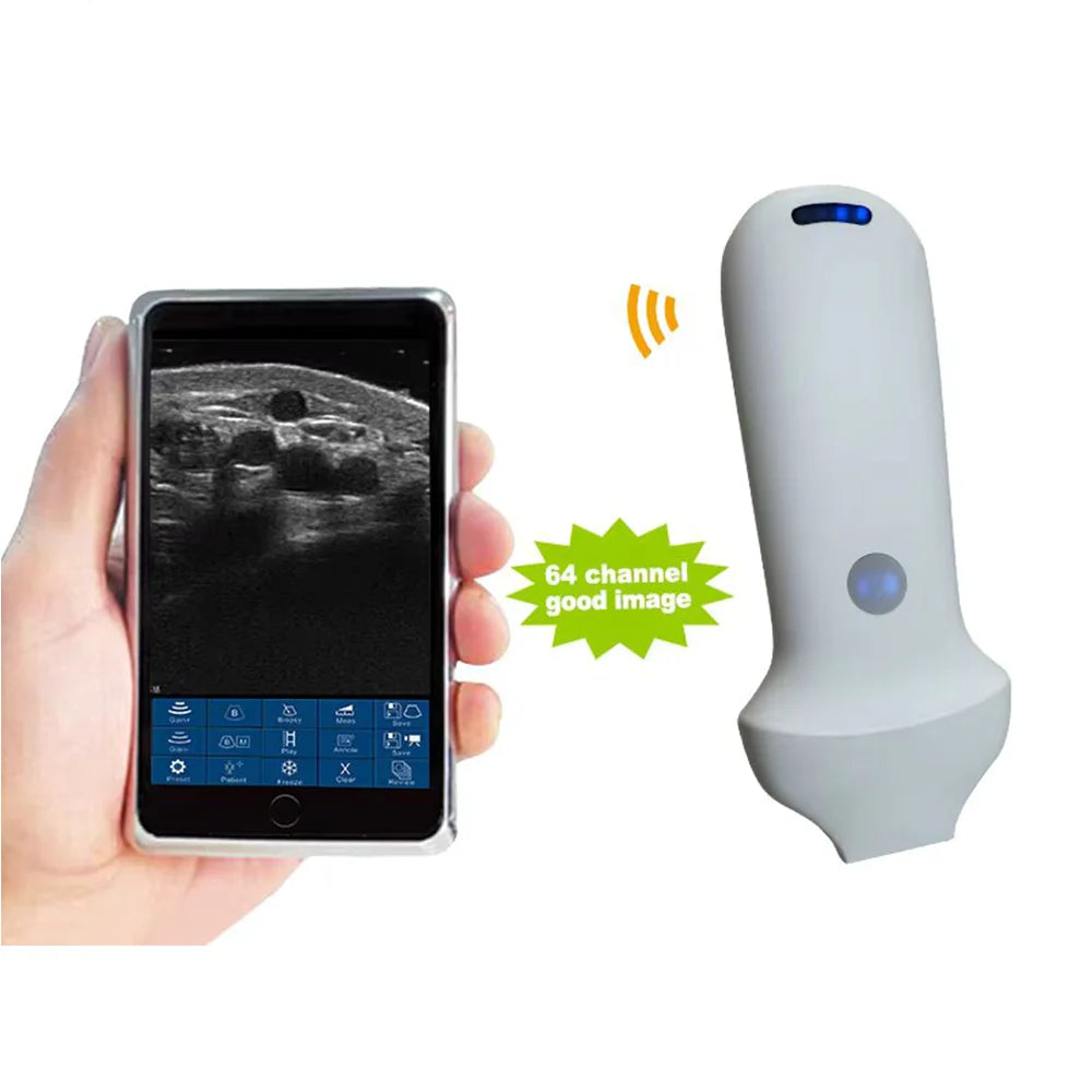 Échographe Portable WiFi 3-en-1 – Sonde Linéaire, Convexe & Transvaginale avec Étui