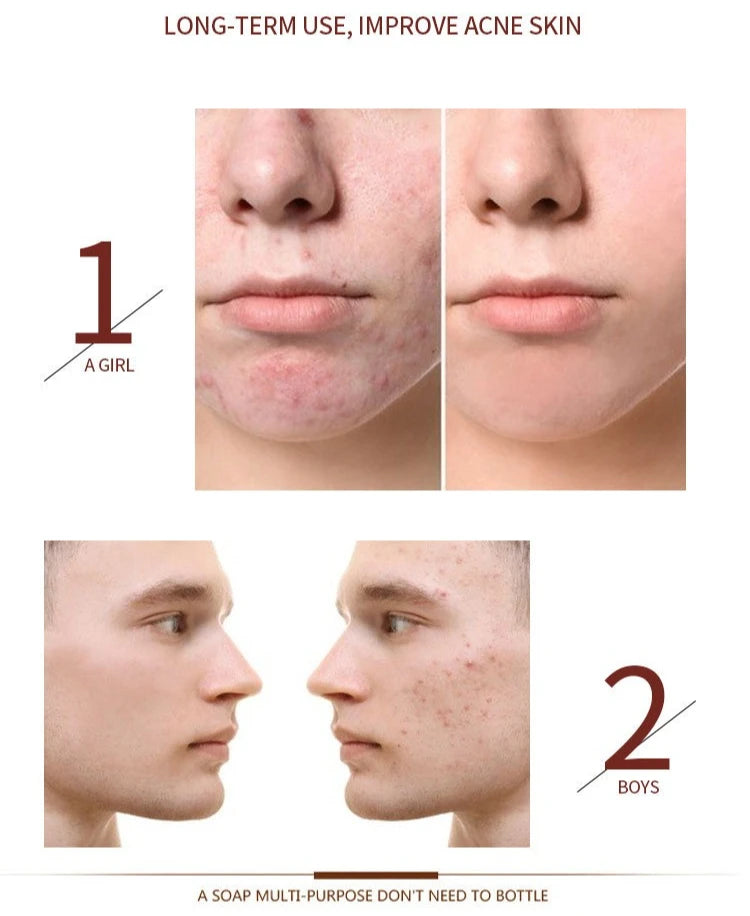 Savon Noir Tibétain Artisanal – Formule Ancestrale aux Plantes Médicinales - BLACKBEARD OUTDOOR INDUSTRIES