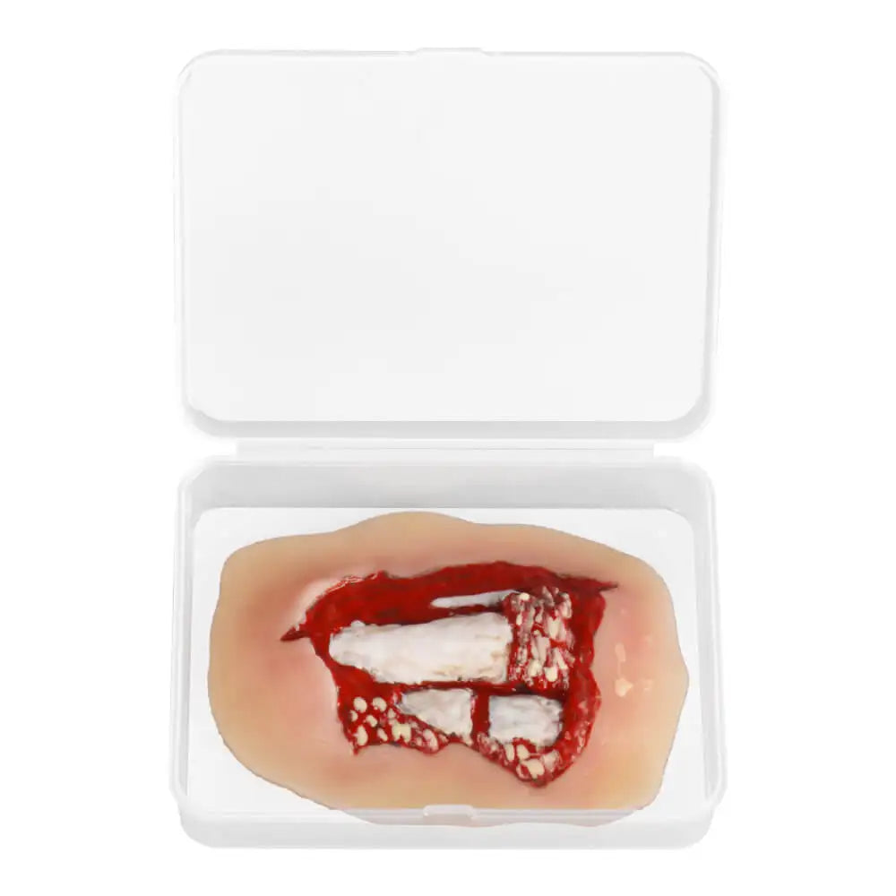 Modèle de Plaie Fracture Ouverte Jambe – Silicone Adhésif Trauma Moulage EMT