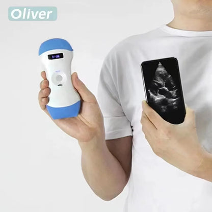 Échographe Portable WiFi 3-en-1 – Sonde Linéaire, Convexe & Transvaginale avec Étui