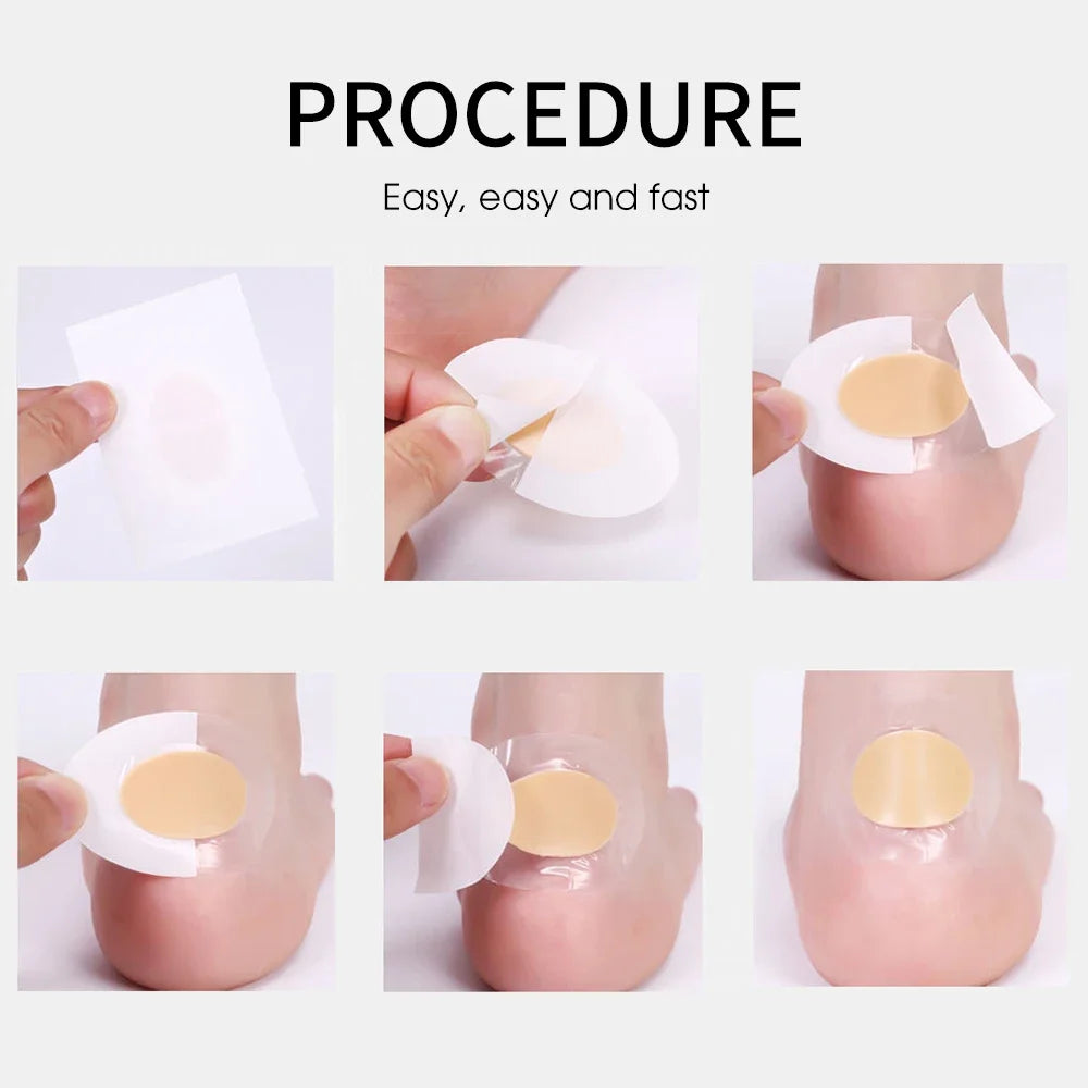 Stickers en Gel Silicone pour Soulagement de la Douleur - 10 à 50 Pièces (Coussins Adhésifs pour Talons et Soins des Pieds) - BLACKBEARD OUTDOOR INDUSTRIES