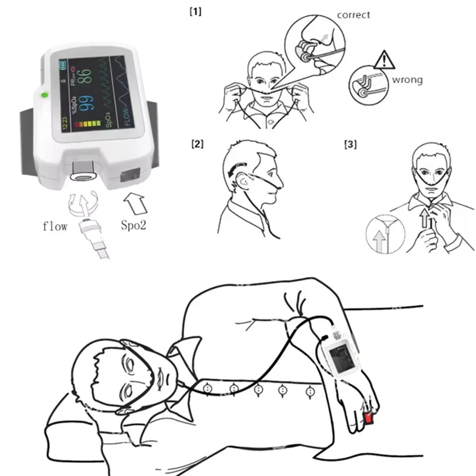 Contec RS01 – Moniteur de Sommeil et Apnée | SpO2, Fréquence Cardiaque, Flux Nasal, Enregistrement 20h
