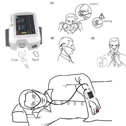 Contec RS01 – Moniteur de Sommeil et Apnée | SpO2, Fréquence Cardiaque, Flux Nasal, Enregistrement 20h
