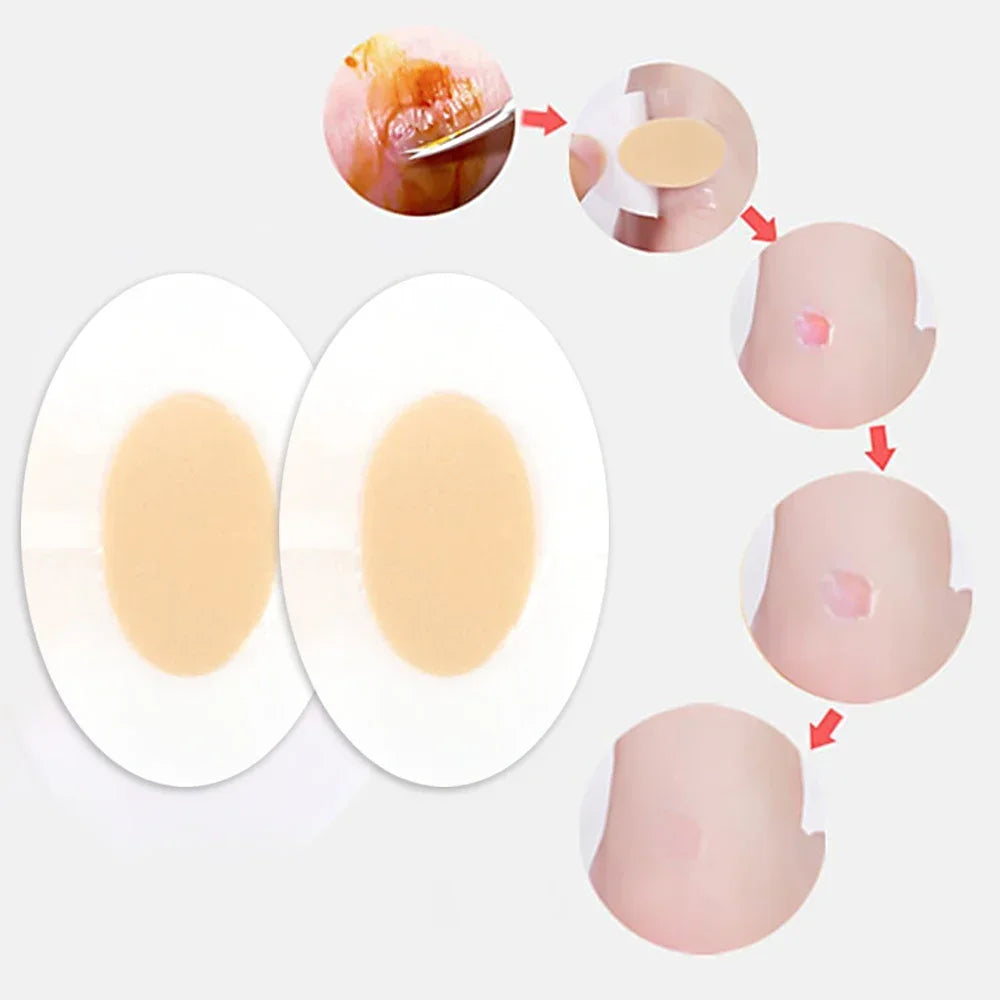 Stickers en Gel Silicone pour Soulagement de la Douleur - 10 à 50 Pièces (Coussins Adhésifs pour Talons et Soins des Pieds) - BLACKBEARD OUTDOOR INDUSTRIES