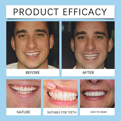 Kit de Silicone pour Dentiers – Kit Complet pour Dents Supérieures et Inférieures, Facile à Utiliser, Soins Dentaires BLACKBEARD OUTDOOR INDUSTRIES