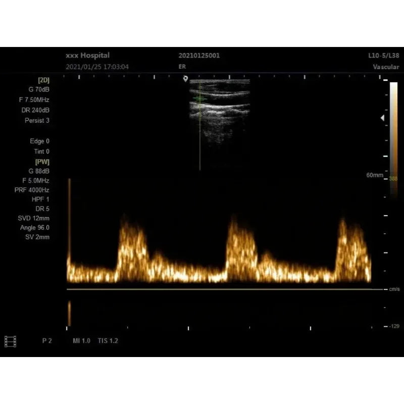 Scanner Ultrason 12 Pouces Portable – Sonde Noir et Blanc échographie (Langue Portugaise) - BLACKBEARD OUTDOOR INDUSTRIES