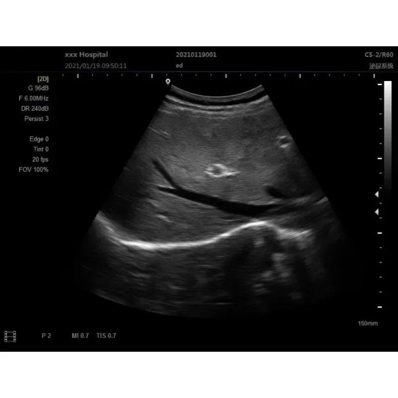 Scanner Ultrason 12 Pouces Portable – Sonde Noir et Blanc échographie (Langue Portugaise) - BLACKBEARD OUTDOOR INDUSTRIES