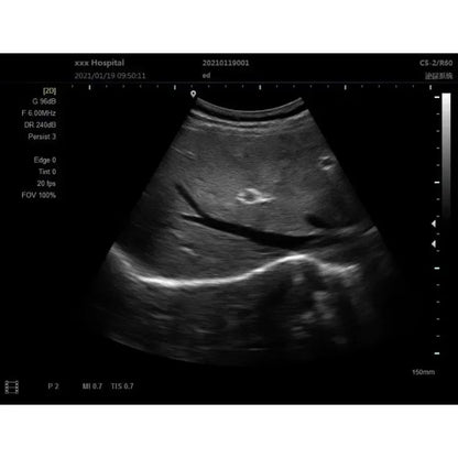 Scanner Ultrason 12 Pouces Portable – Sonde Noir et Blanc échographie (Langue Portugaise) - BLACKBEARD OUTDOOR INDUSTRIES