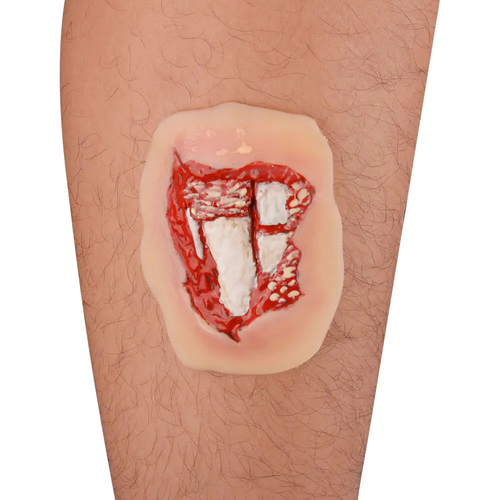 Modèle de Plaie Fracture Ouverte Jambe – Silicone Adhésif Trauma Moulage EMT