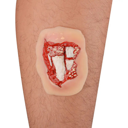 Modèle de Plaie Fracture Ouverte Jambe – Silicone Adhésif Trauma Moulage EMT