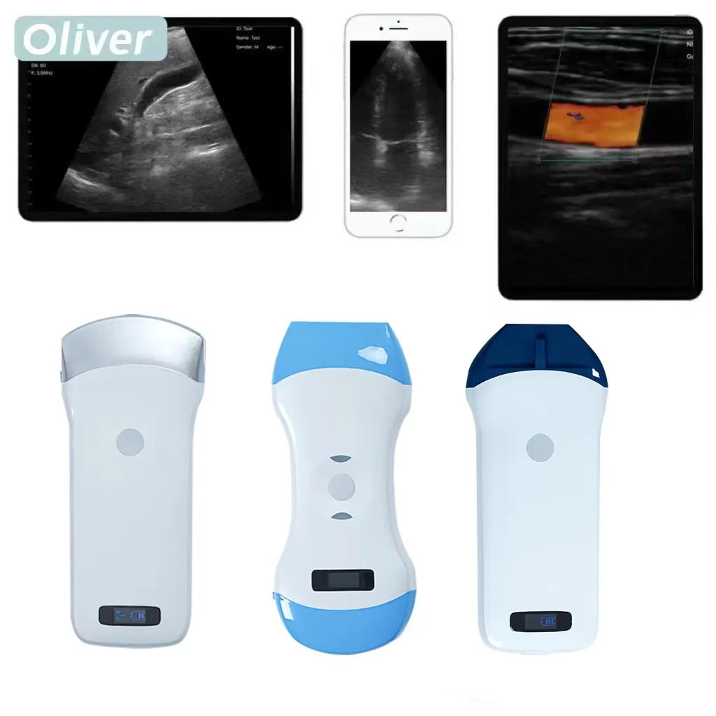 Échographe Portable WiFi 3-en-1 – Sonde Linéaire, Convexe & Transvaginale avec Étui