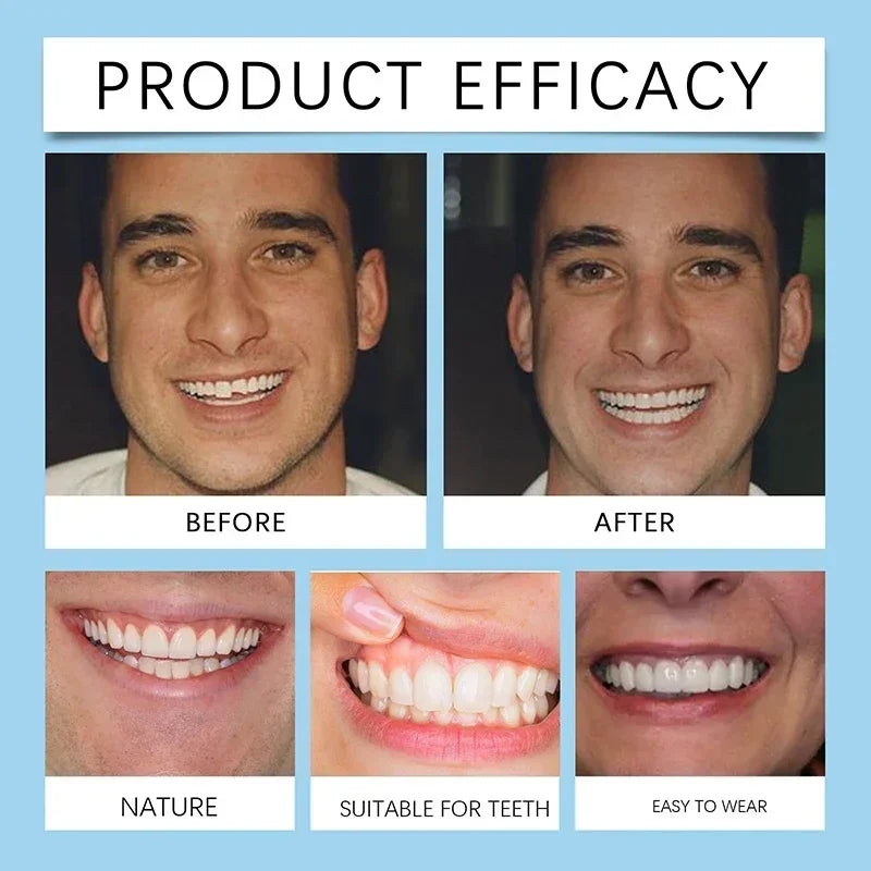 Kit de Silicone pour Dentiers – Kit Complet pour Dents Supérieures et Inférieures, Facile à Utiliser, Soins Dentaires BLACKBEARD OUTDOOR INDUSTRIES