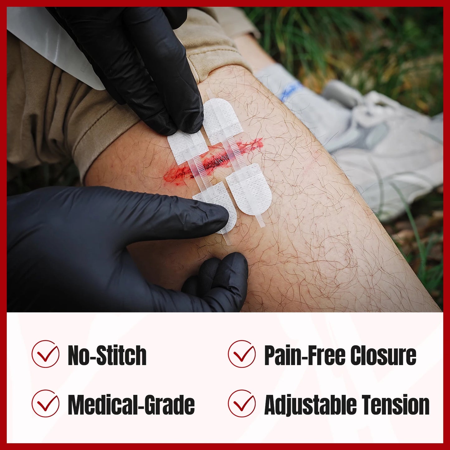 RHINO RESCUE Zip Stitch – Kit Fermeture Plaies, Bandelettes Lacération & Pansements