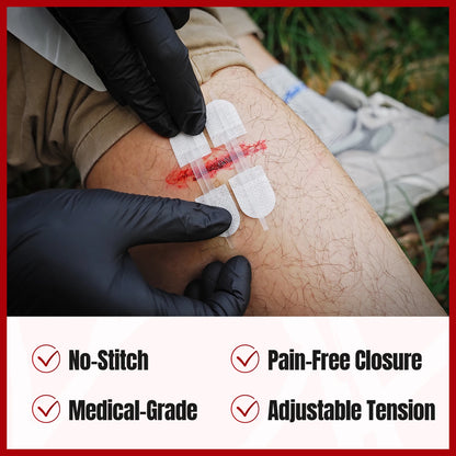 RHINO RESCUE Zip Stitch – Kit Fermeture Plaies, Bandelettes Lacération & Pansements