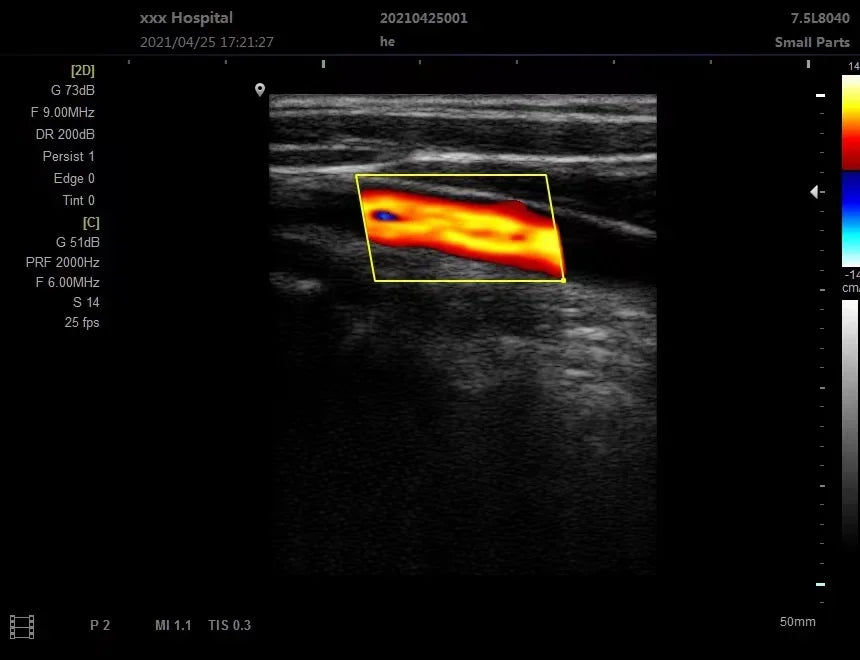 Scanner Ultrason 12 Pouces Portable – Sonde Noir et Blanc échographie (Langue Portugaise) - BLACKBEARD OUTDOOR INDUSTRIES