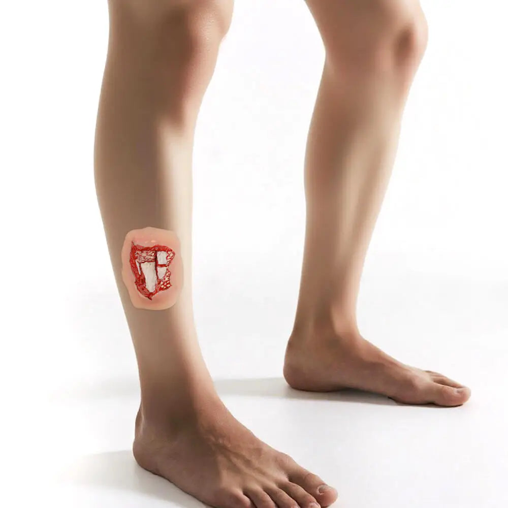 Modèle de Plaie Fracture Ouverte Jambe – Silicone Adhésif Trauma Moulage EMT